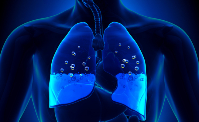 mal di montagna: cosa fare?