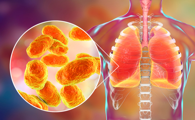 A cosa serve una broncoscopia