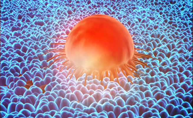 iamgenius: soluzioni per pazienti oncologici