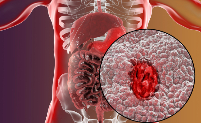 Proprietà e benefici dei ravanelli