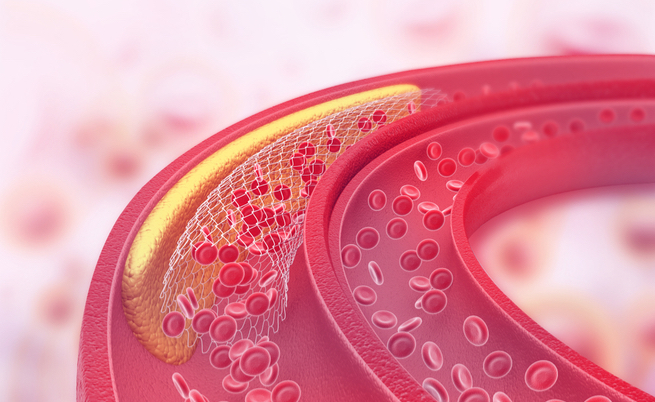 il burro fa male o bene?