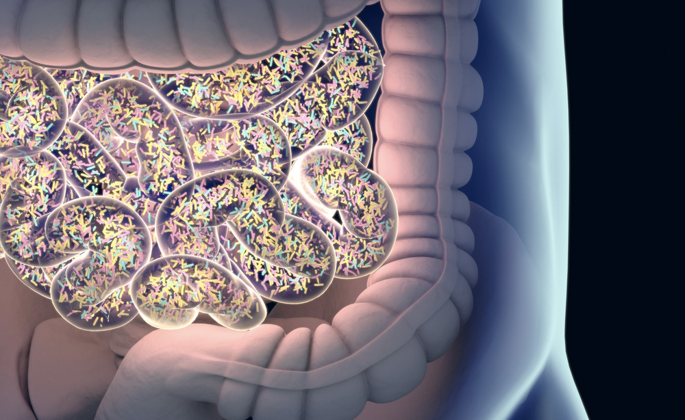 Gonfiore Addominale: 10 Cause