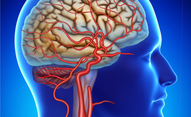 arterite di horton: sintomi e complicanze