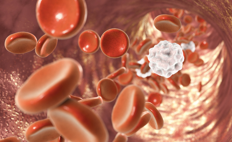 Anemia: i diversi Tipi