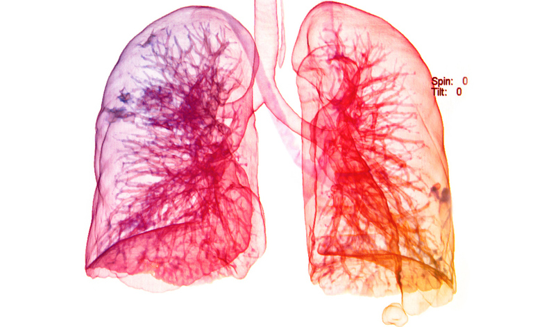 Inquinamento: gli Effetti sulla Salute