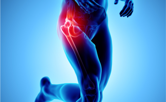 protesi anca: l'operazione chirurgica