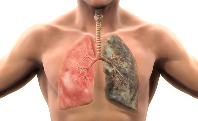 fumo e malattie: quali sono determinate dal tabacco