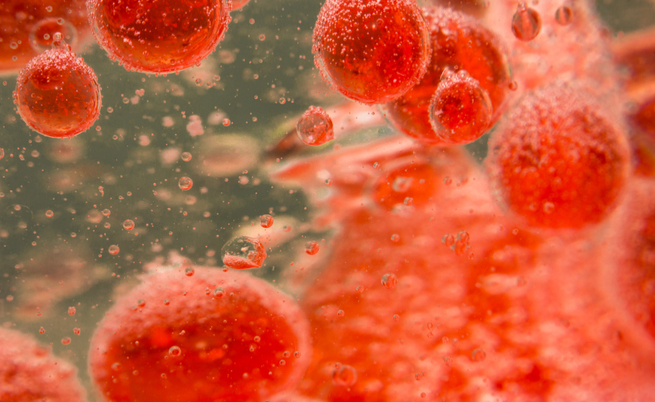 esami carenza di ferro: quali fare?