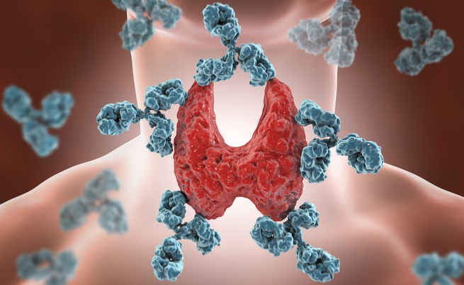 tiroide di hashimoto esenzione dal ticket: quando è previsto