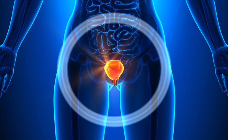 Cistite: i Rimedi per ritrovare il Benessere