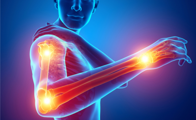 Le cause della debolezza alle braccia