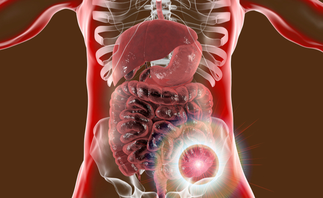 viagra per il tumore al colon-retto: potrebbe prevenirlo