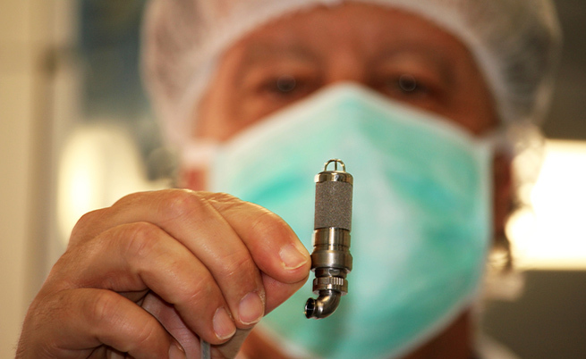 mini-cuore artificiale: salva una bambina di 3 anni all'Ospedale Bambino Gesù di Roma