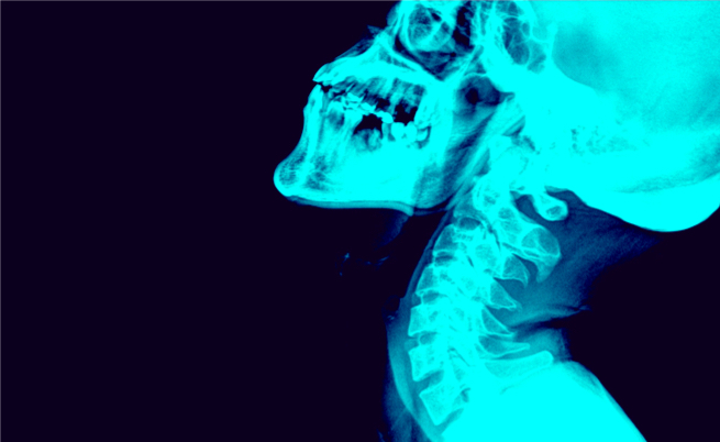 risonanza magnetica: chi non può farla