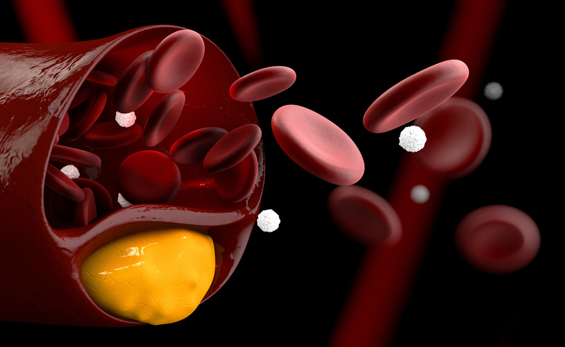 Analisi del sangue: come Valutare il proprio Metabolismo