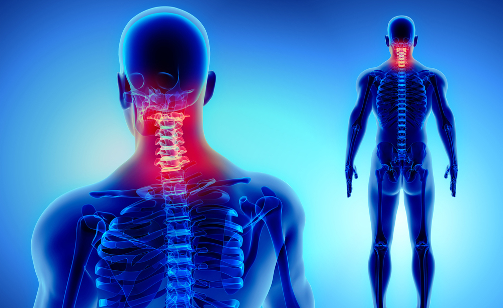 Cervicale e Apnee Notturne: il legame tra le due Patologie