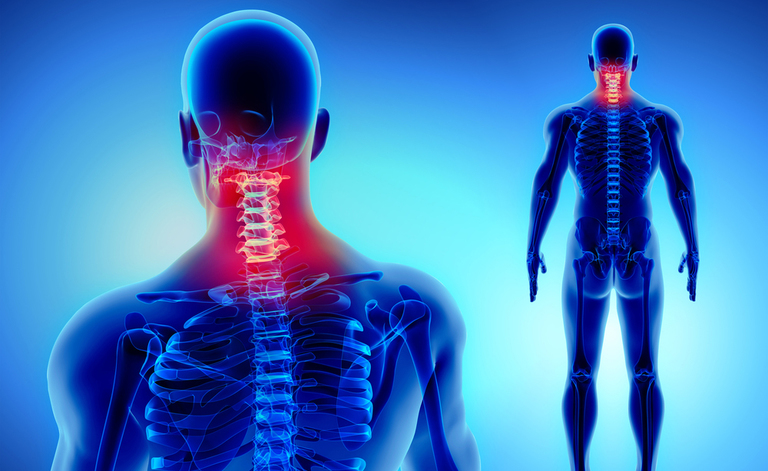 Cervicale e Apnee Notturne: il legame tra le due Patologie