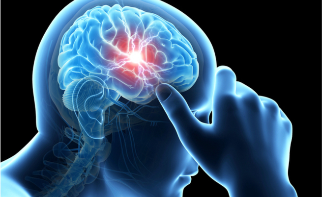 ictus donne: fattori di rischio e prevenzione