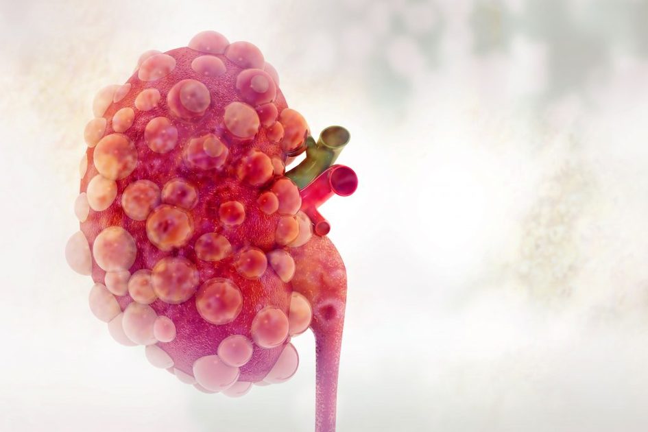 Occhi e reni: le malattie degli occhi causate da problemi renali