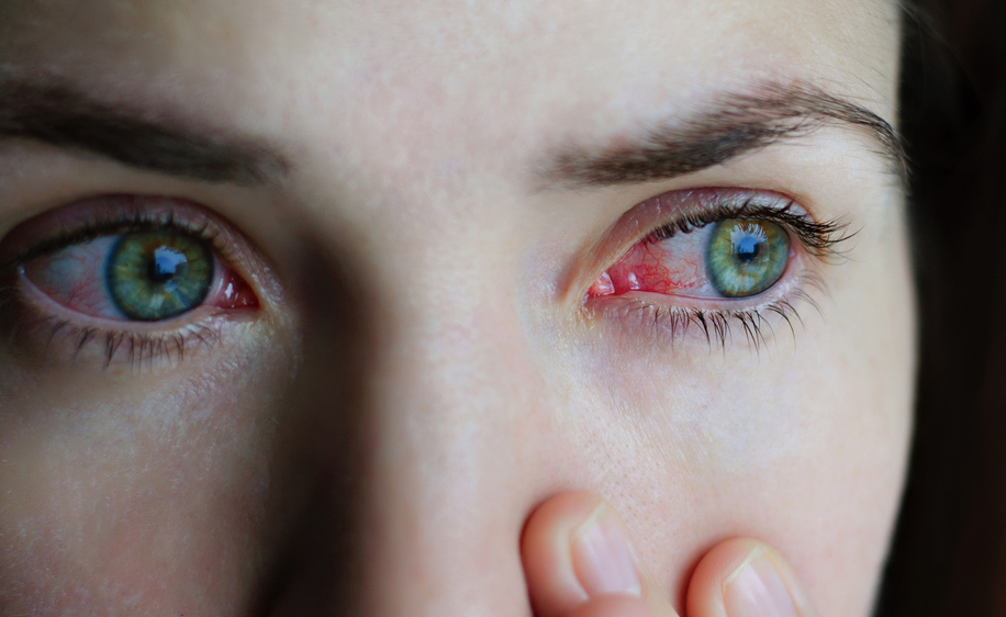 Glaucoma: le Cure più innovative