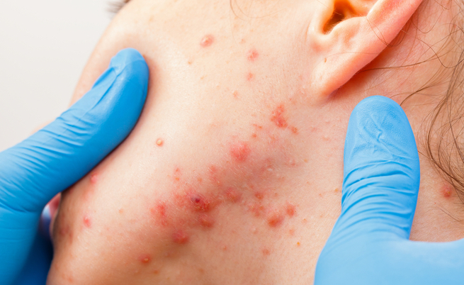 cura della pelle: i prodotti sconsigliati dai dermatologi