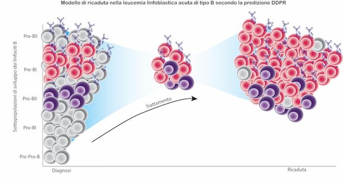 Leucemia linfoblastica acuta