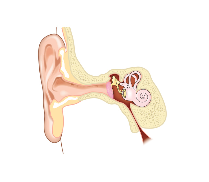 Come prevenire la perdita di udito e la sordità: i consigli 