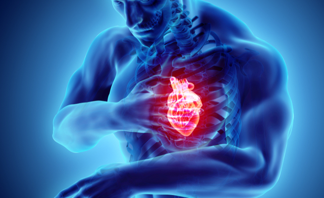 Extrasistole: sintomi, cause e cura