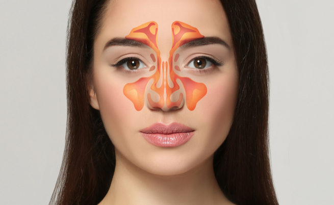 Quali sono i rimedi naturali contro la sinusite? Ecco i più efficacia