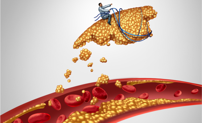 colesterolo negli anziani: quando i valori sono troppo alti?
