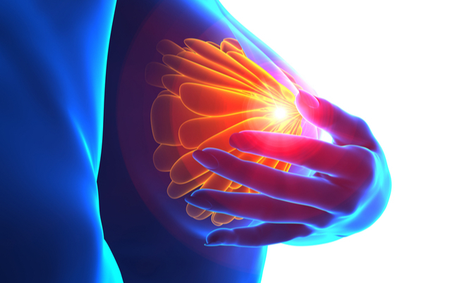 Farmaco tumore al seno: quali sono?