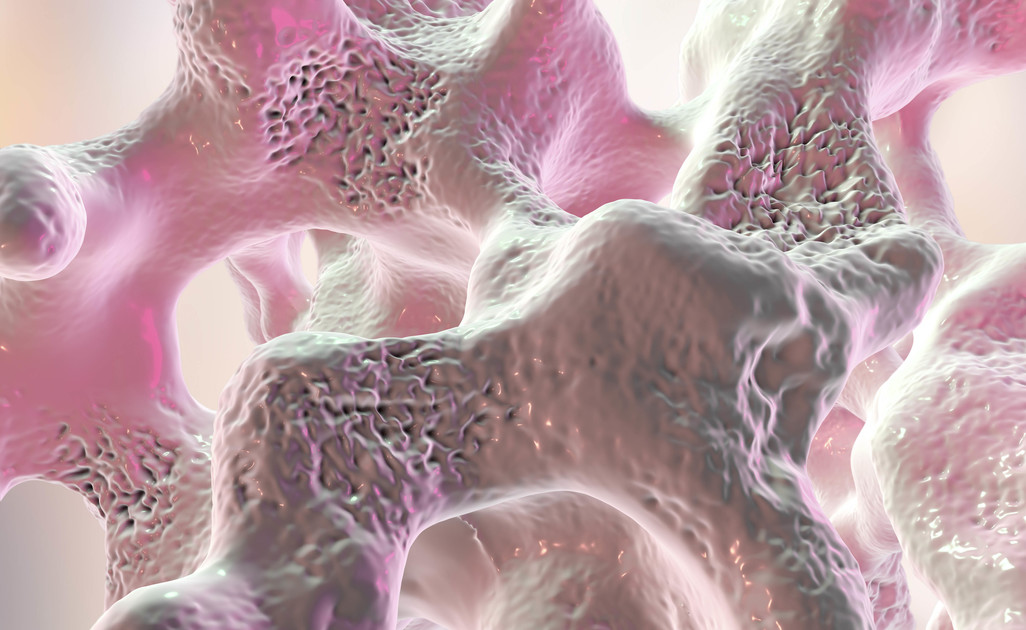 Come si diagnostica l'osteoporosi? Vediamo insieme quali sono gli esami consigliati