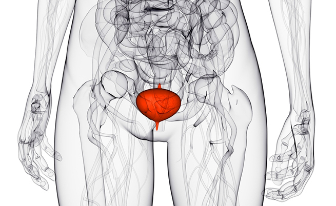 prolasso genitale: cause e sintomi