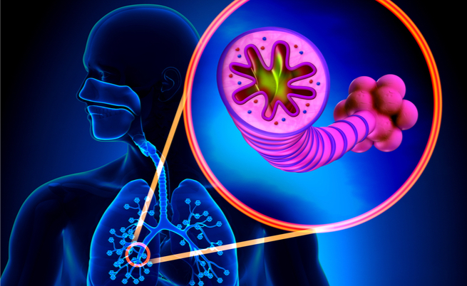 Cura per la BPCO: ecco un nuovo intervento con il vapore