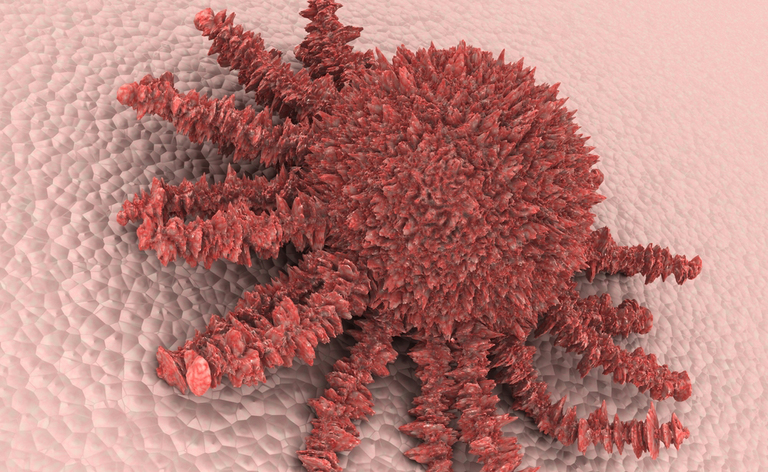 Cancro: le modifiche genetiche che causano il tumore. I risultati della scienza nella lotta al cancro.