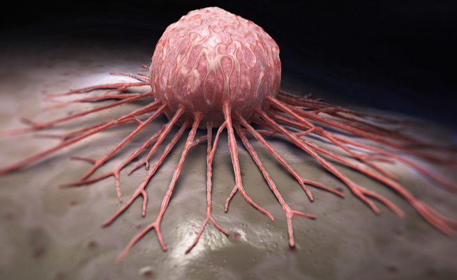 I falsi miti sul cancro: ecco quali sono