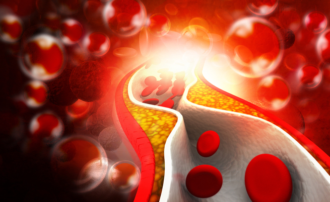 Kiwi e colesterolo: un alleato per combattere il colesterolo alto