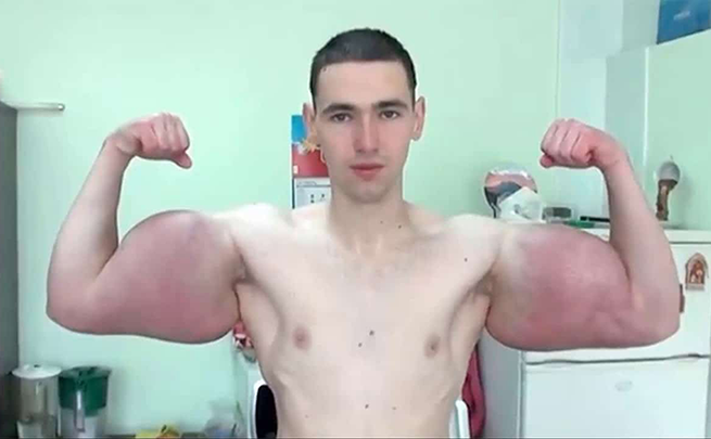 Synthol: la storia di Kirill Tereshin