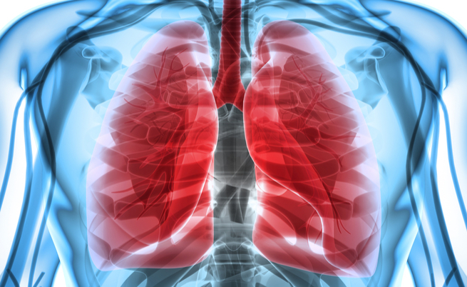 Addensamento polmonare: tutte le cause