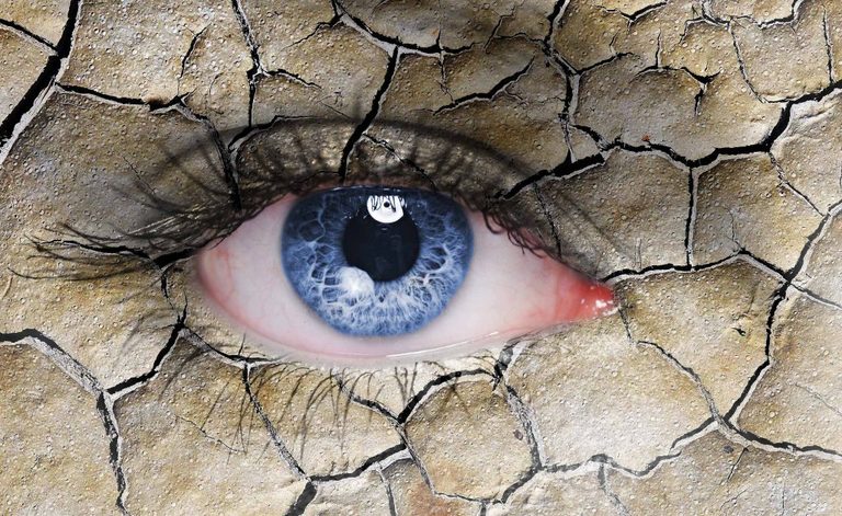 occhio secco: attenzione alle lenti a contatto!