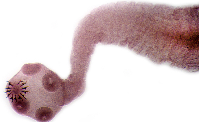 I vermi del cervello: i rischi più comuni