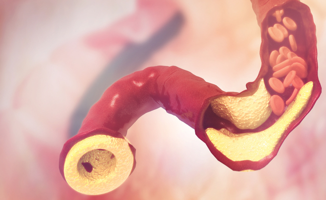 Colesterolo alto: ecco la molecola che lo abbassa