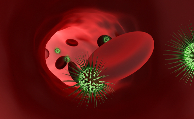 I sintomi della sepsi o della setticemia