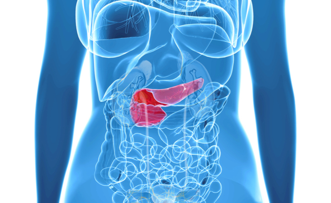 Diagnosi precoce del tumore al pancreas