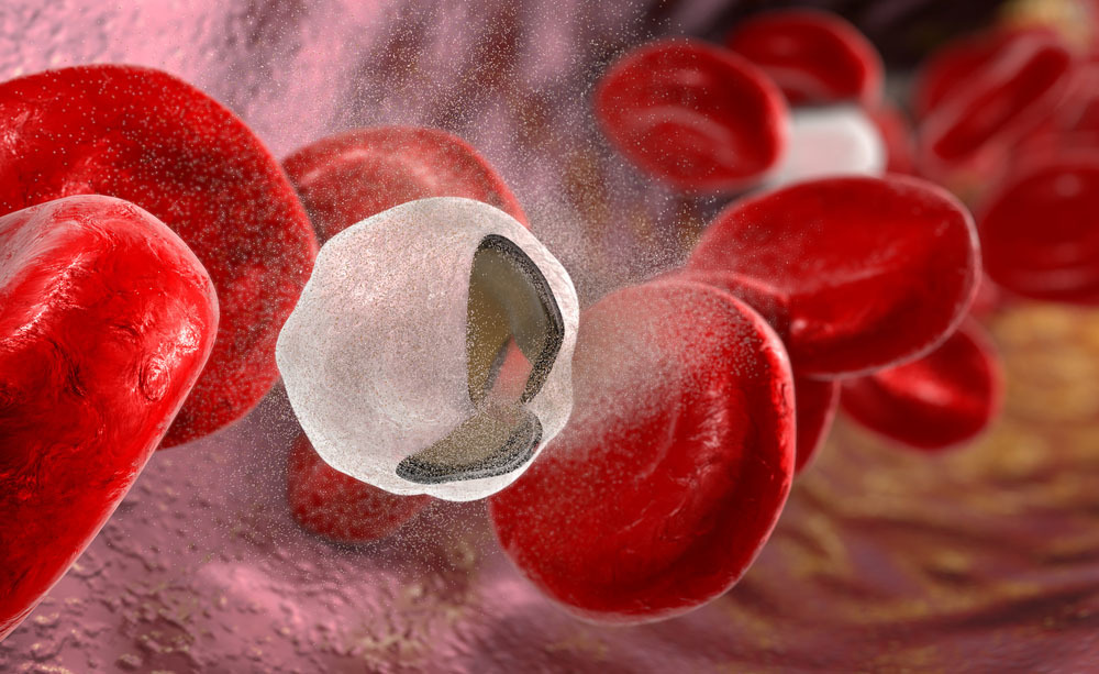 anemia: cosa mangiare e l'importanza della vitamina D