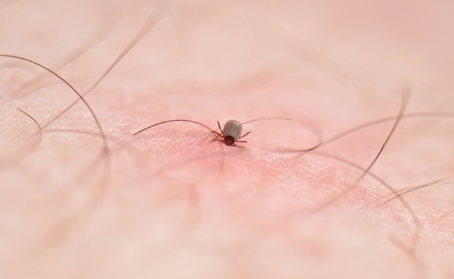 Malattia di Lyme causata dal morso di una zecca