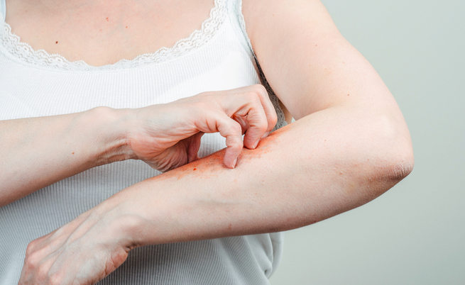 Ecco come imparare a smettere di grattarsi le croste