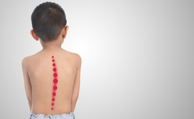 Zaino pesante a scuola: i rischi per la salute