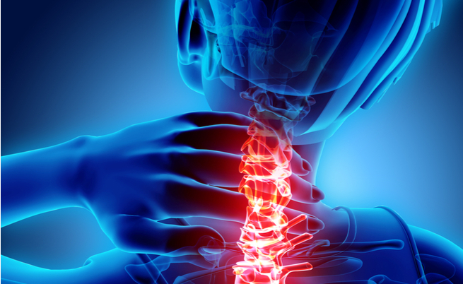 Dolore cervicale: i rimedi naturali