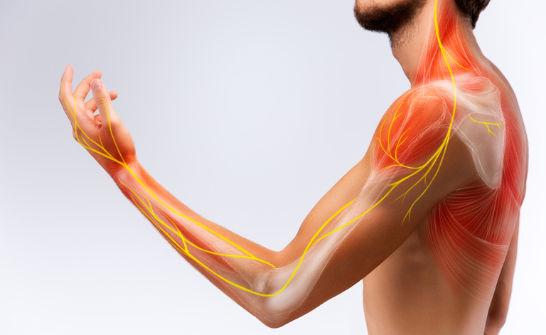 strappo muscolare: i sintomi e le cause